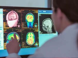 La adolescencia dura hasta los 32 años, según un nuevo estudio