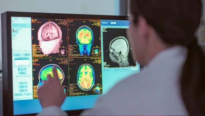 La adolescencia dura hasta los 32 años, según un nuevo estudio