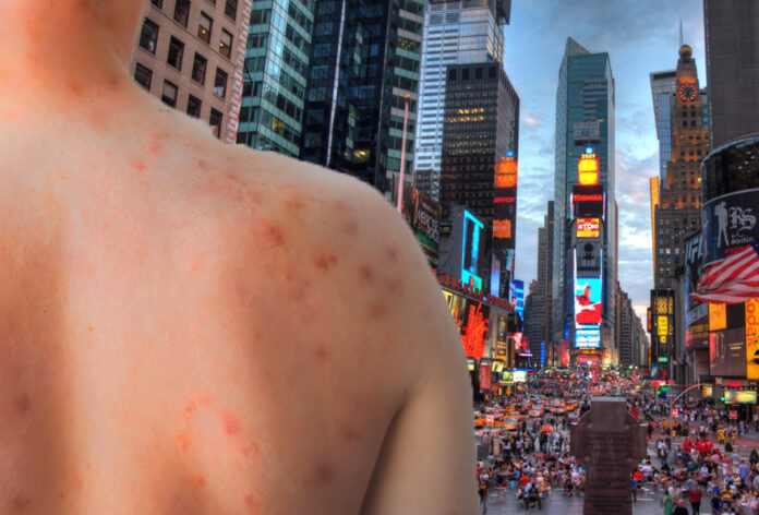 Nueva York declara emergencia sanitaria por sarampión